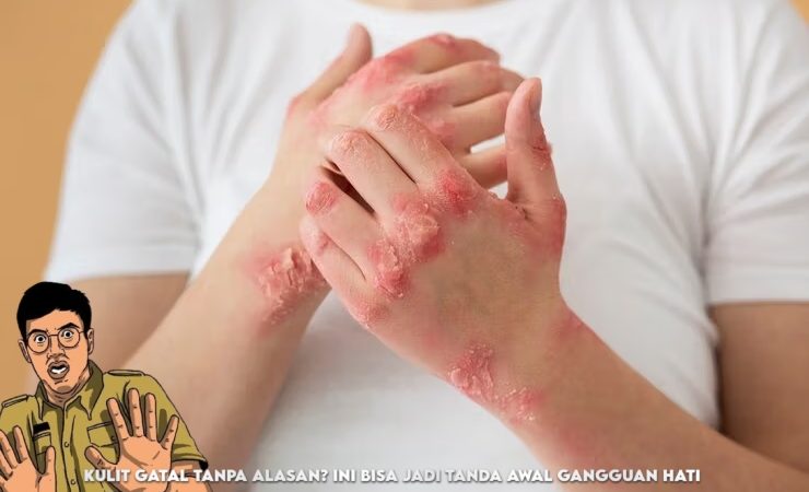 Kulit Gatal Tanpa Alasan? Ini Bisa Jadi Tanda Gejala Awal Gangguan Hati