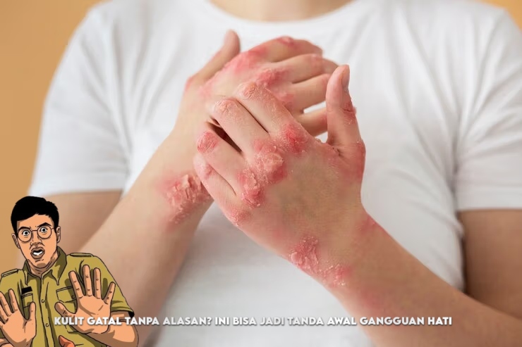 Kulit Gatal Tanpa Alasan? Ini Bisa Jadi Tanda Gejala Awal Gangguan Hati