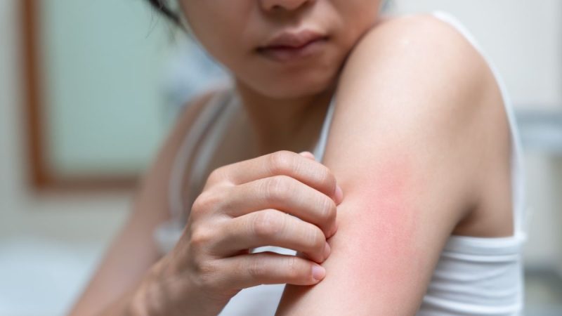 Kulit Sering Gatal Tanpa Sebab? Waspadai Gejala Awal Gangguan Hati